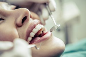 materiały stomatologiczne do wypełnień zęba