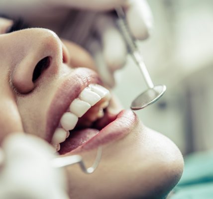 materiały stomatologiczne do wypełnień zęba